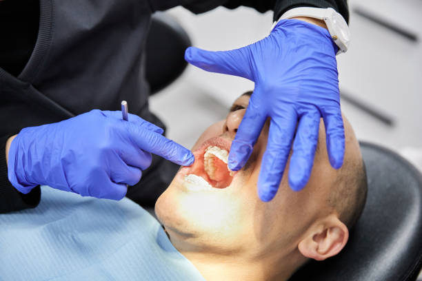 Best Emergency Wisdom Teeth Removal in Valparaiso, IN